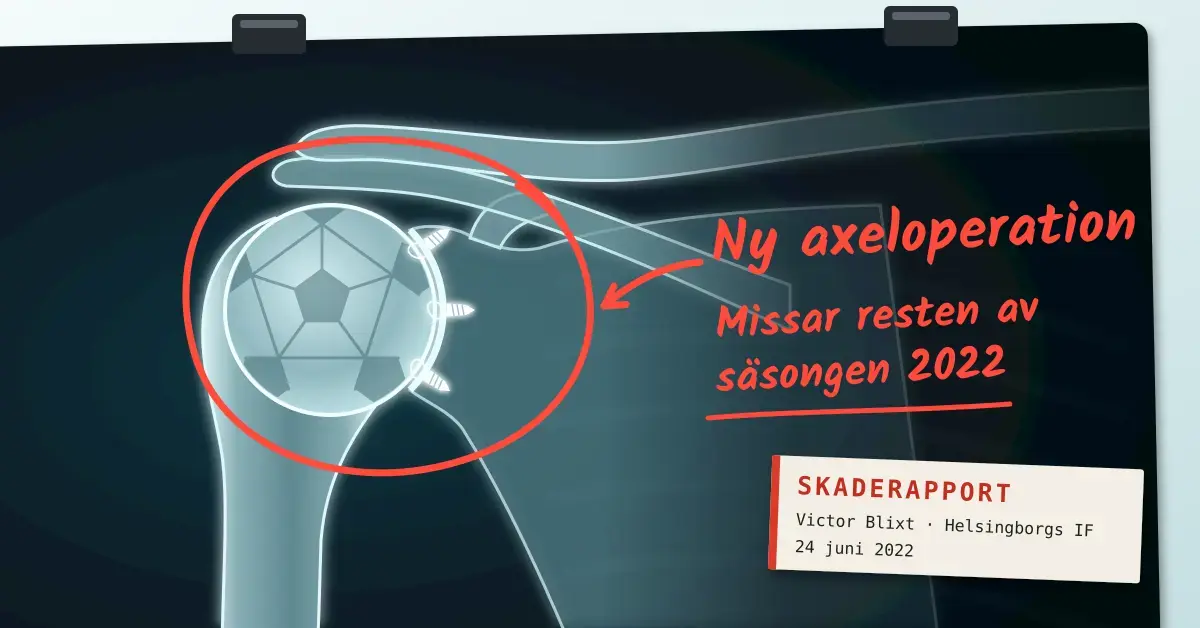 Illustration av en röntgenbild av en axel där ledhuvudet är format som en fotboll och tre operationsankare sitter i ledskålen, med leden inringad i rött och den handskrivna kommentaren ”Ny axeloperation – Missar resten av säsongen 2022” samt en etikett med texten ”Skaderapport, Victor Blixt · Helsingborgs IF, 24 juni 2022”.